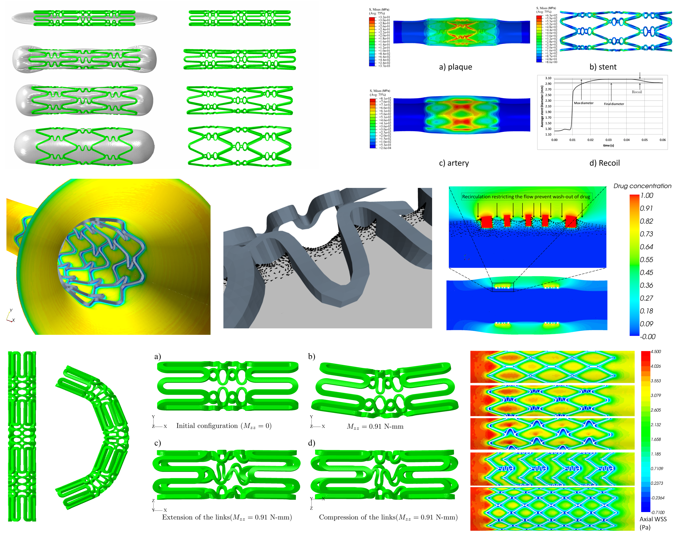 stent-various-simulations